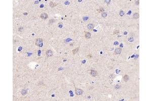 Immunohistochemistry analysis of parafffin-embedded rat brain using P2RX3 Polyclonal Antibody at dilution of 1:400. (P2RX3 anticorps)