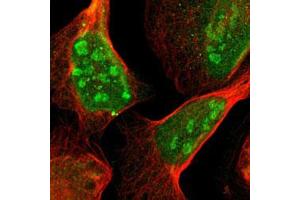 Immunofluorescent staining of U-2 OS with ATP6AP2 polyclonal antibody  (Green) shows positivity in nucleus and nucleoli. (ATP6AP2 anticorps)