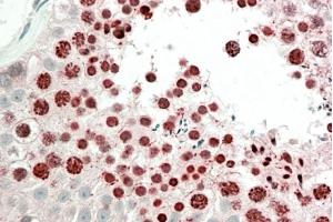 ABIN5868646 (5 µg/ml) staining of paraffin embedded Human Testis. (HOXA10 anticorps)