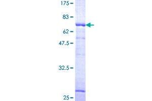Image no. 1 for Mevalonate (Diphospho) Decarboxylase (MVD) (AA 1-400) protein (GST tag) (ABIN1311670)