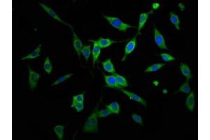 Immunofluorescence staining of NIH/3T3 cells with ABIN7143720 at 1:166, counter-stained with DAPI.
