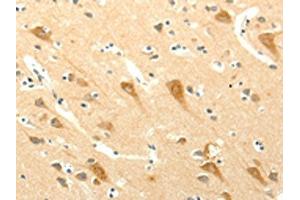 The image on the left is immunohistochemistry of paraffin-embedded Human brain tissue using ABIN7131272(SYT5 Antibody) at dilution 1/15, on the right is treated with fusion protein. (Synaptotagmin V anticorps)