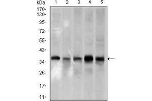 Western blot analysis using PCNA mouse mAb against A431 (1), HeLa (2), HepG2 (3), Raji (4), and MOLT4 (5) cell lysate.