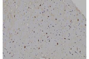 ABIN6266337 and ABIN6277059 at 1/100 staining Human heart tissue by IHC-P.
