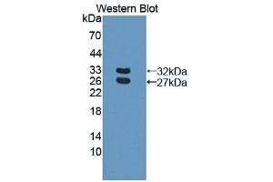 Detection of Recombinant BCAM, Human using Polyclonal Antibody to Basal Cell Adhesion Molecule (BCAM) (BCAM anticorps  (AA 32-257))