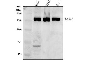 Western blot analysis of SMC4 using anti-SMC4 antibody (ABIN7602662).