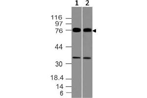 Image no. 1 for anti-Melanoma Associated Antigen (Mutated) 1 (MUM1) (AA 52-278) antibody (ABIN5027377) (MUM1 anticorps  (AA 52-278))