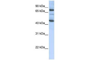 GAS2L1 antibody used at 1 ug/ml to detect target protein. (GAS2L1 anticorps  (Middle Region))