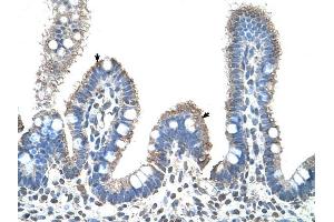 SLC22A1 antibody was used for immunohistochemistry at a concentration of 4-8 ug/ml to stain Epithelial cells of intestinal villus (arrows) in Human Intestine.