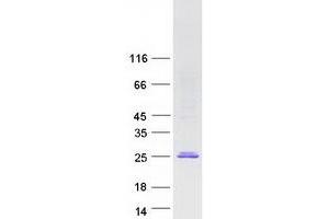 Validation with Western Blot
