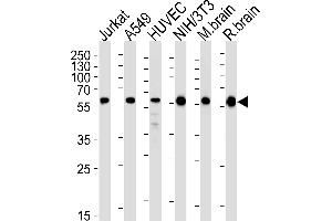 Western blot analysis of lysates from Jurkat, A549, HUVEC, mouse NIH/3T3 cell line and mouse brain, rat brain tissue lysates (from left to right), using RAD23B Antibody (N-term) (ABIN1944896 and ABIN2843646). (RAD23B anticorps  (N-Term))