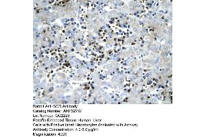 anti-Stearoyl-CoA Desaturase (Delta-9-Desaturase) (SCD) (Middle Region) antibody