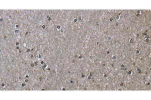 Immunohistochemistry of paraffin-embedded Human brain using HSPA9 Polyclonal Antibody at dilution of 1:50