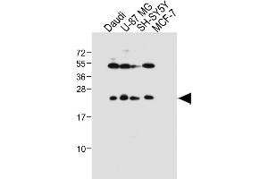 All lanes : Anti-PRL Antibody (Center) at 1:1000 dilution Lane 1: Daudi whole cell lysate Lane 2: U-87 MG whole cell lysate Lane 3: SH-SY5Y whole cell lysate Lane 4: MCF-7 whole cell lysate Lysates/proteins at 20 μg per lane. (Prolactin anticorps  (AA 48-76))