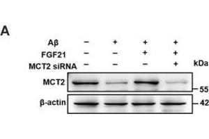 The roles of MCTs in the beneficial effects of FGF21. (SLC16A7 anticorps  (C-Term))