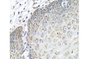 Immunohistochemistry of paraffin-embedded Human esophagus using TMOD3 Polyclonal Antibody at dilution of 1:100 (40x lens). (TMOD3 anticorps)