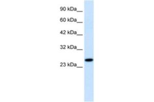 Western Blotting (WB) image for anti-Regulator of G-Protein Signaling 13 (RGS13) antibody (ABIN2460853) (RGS13 anticorps)