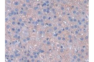 Detection of CYGB in Rat Adrenal gland Tissue using Polyclonal Antibody to Cytoglobin (CYGB) (CYGB anticorps  (AA 1-190))