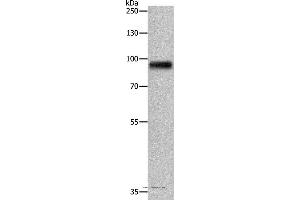Western blot analysis of Human fetal brain tissue, using APLP1 Polyclonal Antibody at dilution of 1:650