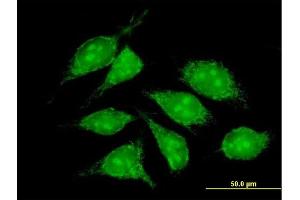 Immunofluorescence of purified MaxPab antibody to COX5B on HeLa cell.