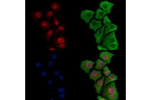 ABIN7093391 and ABIN7097412 staining Hela cells by IF/ICC.