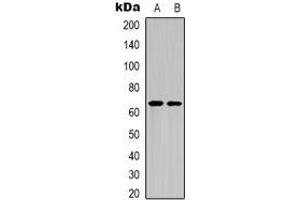 Western blot analysis of NF-kappaB p65 (AcK122) expression in HepG2 UV-treated (A), mouse brain (B) whole cell lysates. (NF-kB p65 anticorps  (acLys122))
