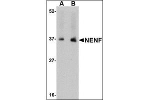 Western blot analysis of NENF in human kidney tissue lysate with this product at (A) 1 and (B) 2 μg/ml. (Neudesin anticorps  (C-Term))