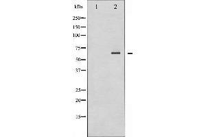 Western blot analysis of SHP-2 expression in A431 whole cell lysates,The lane on the left is treated with the antigen-specific peptide. (PTPN11 anticorps  (C-Term))