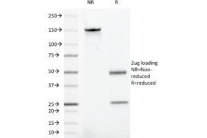 SDS-PAGE Analysis Purified CD43 Mouse Recombinant Monoclonal Antibody (rSPN/1094). (Recombinant CD43 anticorps)