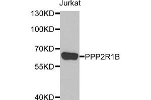 Western blot analysis of extracts of Jurkat cell line, using PPP2R1B antibody. (PPP2R1B anticorps)