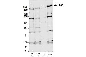 Western Blotting (WB) image for anti-Ubiquitin Protein Ligase E3 Component N-Recognin 4 (UBR4) (AA 1350-1400) antibody (ABIN7454815)