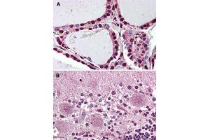 Immunohistochemical staining of human thyroid (A) and human brain, cerebellum (B) with PROKR2 polyclonal antibody . (Prokineticin Receptor 2 anticorps  (N-Term))