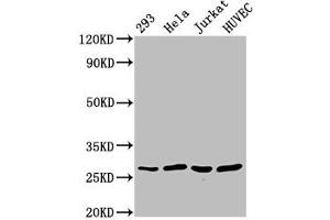 Western Blot Positive WB detected in: 293 whole cell lysate, Hela whole cell lysate, Jurkat whole cell lysate, HUVEC whole cell lysate All lanes: CACYBP antibody at 2.