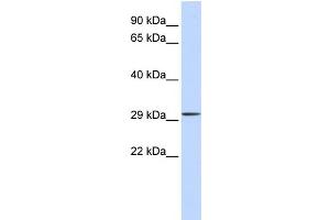 WB Suggested Anti-C1orf111 Antibody Titration:  0. (C1ORF111 anticorps  (Middle Region))