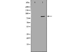Western blot analysis of Hela whole cell lysates, using NDUFS1 Antibody.