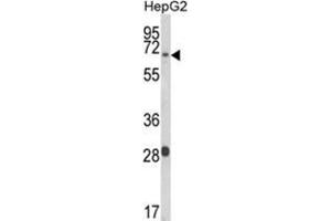 Western blot analysis of WAC Antibody (Center) in HepG2 cell line lysates (35 µg/lane).