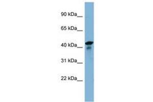 Image no. 1 for anti-UEV and Lactate/malate Dehyrogenase Domains (UEVLD) (AA 35-84) antibody (ABIN6742157) (UEVLD anticorps  (AA 35-84))