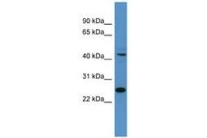 Image no. 1 for anti-Transcription Factor Dp-1 (TFDP1) (AA 21-70) antibody (ABIN6746158) (DP1 anticorps  (AA 21-70))
