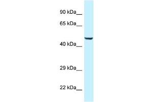 WB Suggested Anti-C9orf156 Antibody Titration: 1. (C9orf156 anticorps  (Middle Region))