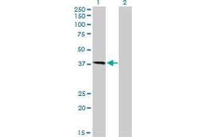 Western Blot analysis of HFE expression in transfected 293T cell line by HFE monoclonal antibody (M01), clone 1G12.