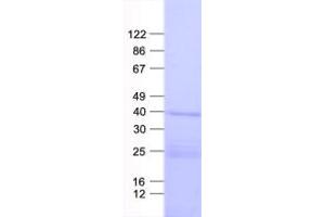 Validation with Western Blot
