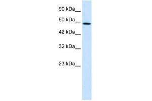 WB Suggested Anti-TBC1D10B Antibody Titration:  1. (TBC1D10B anticorps  (C-Term))