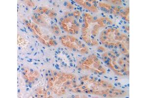 IHC-P analysis of kidney tissue, with DAB staining. (CUBN anticorps  (AA 3511-3623))