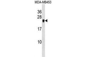 CRIP2 Antibody (C-term) western blot analysis in MDA-MB453 cell line lysates (35µg/lane). (CRIP2 anticorps  (C-Term))
