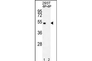 Western blot analysis of E2F1 Antibody  Pab (ABIN391858 and ABIN2841689) pre-incubated without(lane 1) and with(lane 2) blocking peptide in 293T cell line lysate. (E2F1 anticorps  (AA 342-371))