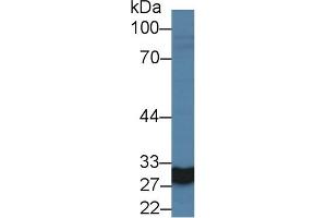 Detection of CA5A in Rat Heart lysate using Polyclonal Antibody to Carbonic Anhydrase VA (CA5A)