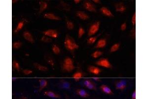 Immunofluorescence analysis of NIH/3T3 cells using ENO3 Polyclonal Antibody at dilution of 1:100.
