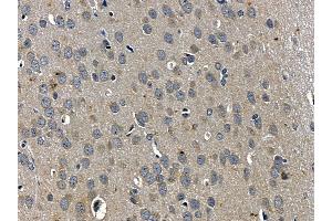 ABIN6257674 and ABIN6275488 at 1/100 staining rat brain tissue by IHC-P.