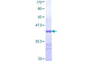Image no. 1 for Sperm Adhesion Molecule 1 (PH-20 Hyaluronidase, Zona Pellucida Binding) (SPAM1) (AA 346-445) protein (GST tag) (ABIN1321072)