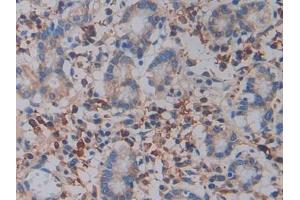 anti-Integrin beta 3 (ITGB3) (AA 135-377) antibody